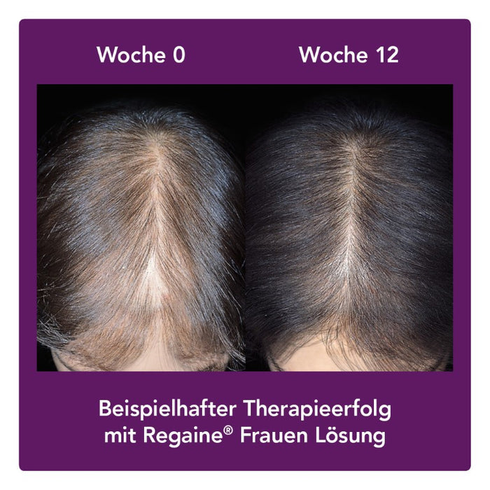 Regaine Frauen Schaum, 120 g Schaum
