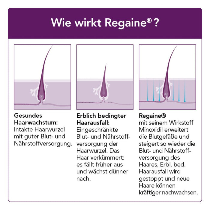 Regaine Frauen Schaum, 120 g Schaum