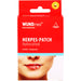 WUNDmed Herpes Patch fast unsichtbare Abdeckung von Lippenherpesbläschen, 6 St. Pflaster