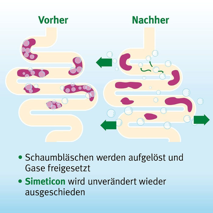 Espumisan Kautabletten bei Blähungen und Völlegefühl, 50 St. Tabletten