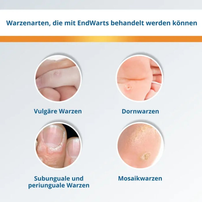 EndWarts PEN F Warzenbehandlung für Hände und Füße, 3 ml Lösung