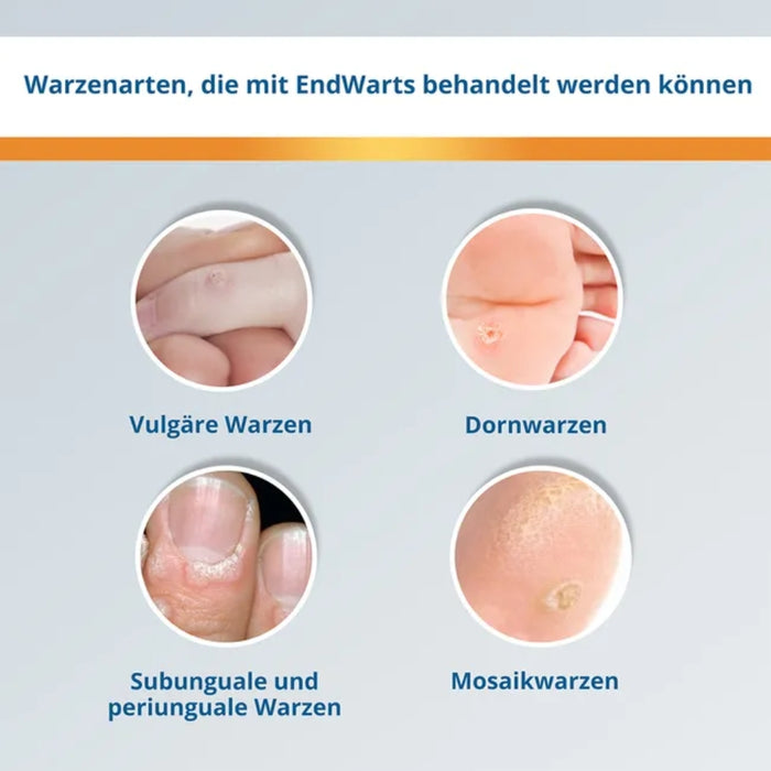 EndWarts classic Warzenbehandlung für Hände und Füße Lösung, 3 ml Lösung