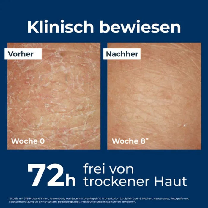 Eucerin UreaRepair plus 10% Urea Lotion, 400 ml Lotion