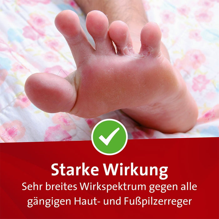 Mykosert Spray bei Haut- und Fußpilz, 60 ml Lösung
