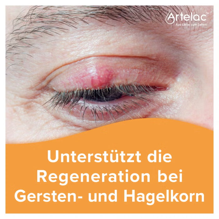 Artelac Augenlidhelfer bei Beschwerden der Augenlider, 15 g Salbe